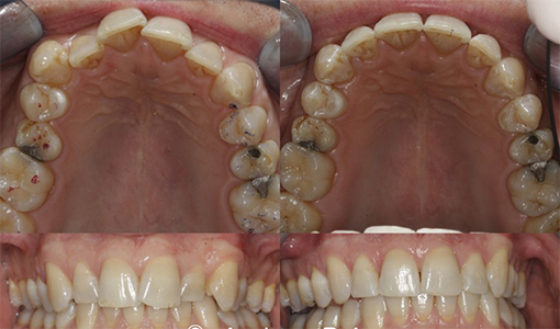 Before After