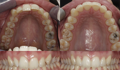 Before After
