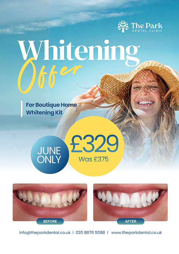 Teeth Whitening Offer